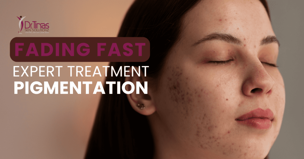 Expert Pigmentation Treatment