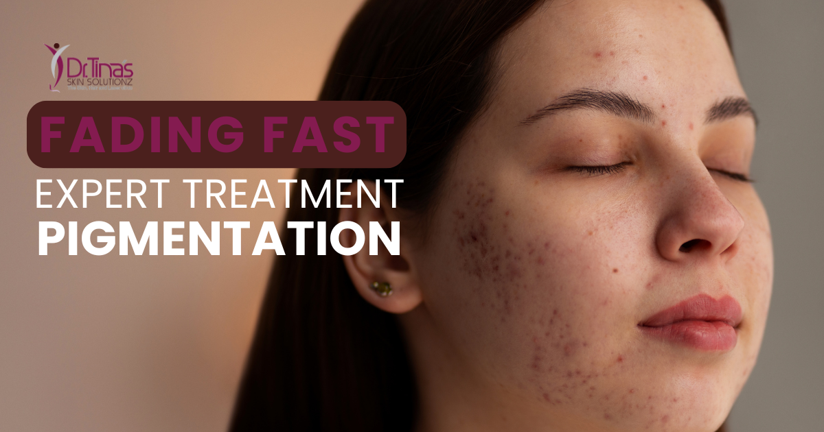 Fading Fast: Expert Pigmentation Treatment