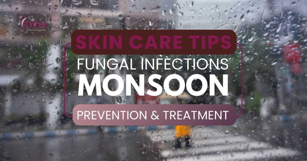 Prevention and Treatment of Fungal Infections During the Monsoon