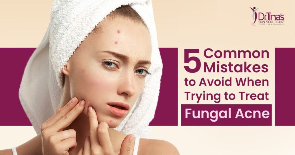 Common mistakes Fungal Acne