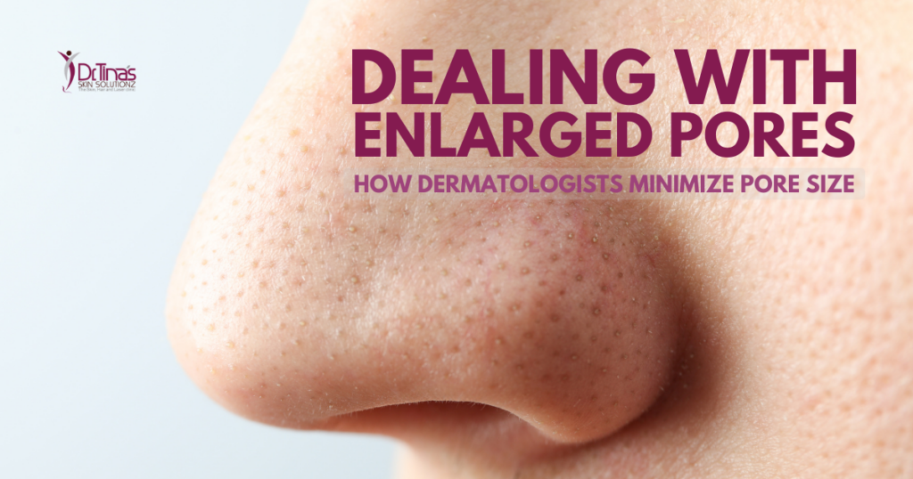 Enlarged Pores Treatment by Dermatologist Bangalore