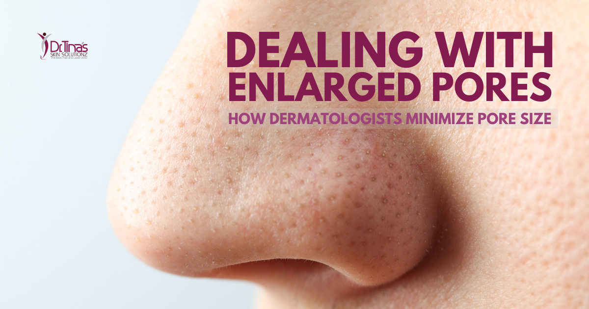 Dealing with Enlarged Pores: How Dermatologists Minimize Pore Size for Clearer Skin