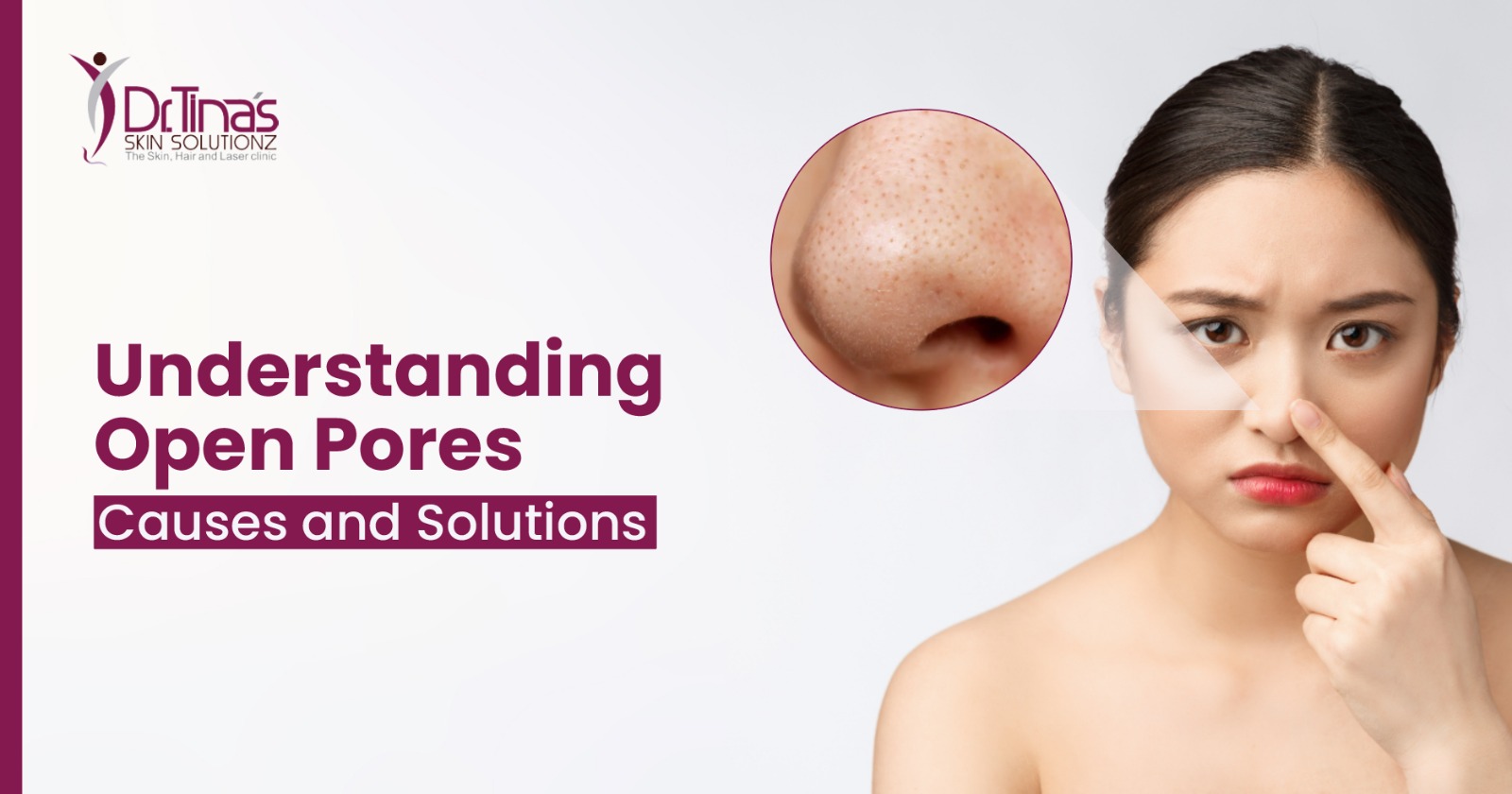 Understanding Open Pores: Causes and Solutions