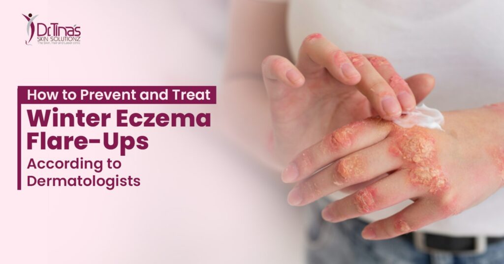 Winter eczma